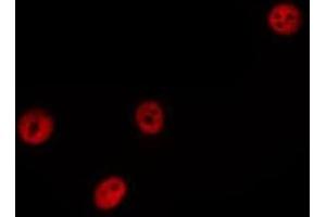 ABIN6275183 staining HepG2 by IF/ICC. (HNRNPCL1 antibody  (C-Term))