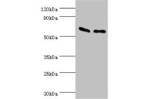Western blot All lanes: ATP synthase subunit beta, mitochondrial antibody at 9 μg/mL Lane 1: Hela whole cell lysate Lane 2: HepG2 whole cell lysate Secondary Goat polyclonal to rabbit IgG at 1/10000 dilution Predicted band size: 57 kDa Observed band size: 57 kDa (ATP5B antibody  (AA 230-529))