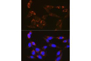 Immunofluorescence analysis of NIH/3T3 cells using PDE4A Rabbit pAb (ABIN7269302) at dilution of 1:100 (40x lens). (PDE4A antibody)
