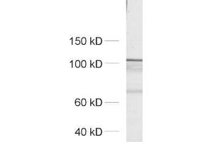 dilution: 1 : 500, sample: crude synaptosomal fraction of rat brain (P2)