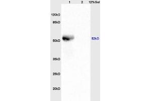 L1 human colon carcinoma lysates, L2 mouse brain lystaes probed (ABIN755647) at 1:200 in 4 °C. (LSP1 antibody  (pSer204))