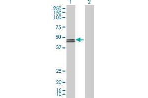 Western Blot analysis of GCDH expression in transfected 293T cell line by GCDH MaxPab polyclonal antibody. (GCDH antibody  (AA 1-438))