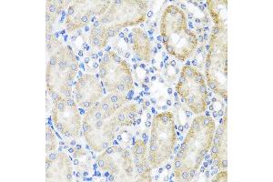 Immunohistochemistry of paraffin-embedded mouse kidney using PSTPIP1 antibody at dilution of 1:100 (x40 lens). (PSTPIP1 antibody)