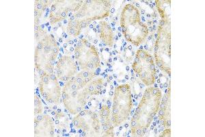 Immunohistochemistry of paraffin-embedded mouse kidney using PSTPIP1 antibody at dilution of 1:100 (x40 lens).