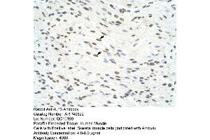 Rabbit Anti-ILF3 Antibody  Paraffin Embedded Tissue: Human Muscle Cellular Data: Skeletal muscle cells Antibody Concentration: 4. (Interleukin enhancer-binding factor 3 (ILF3) (N-Term) antibody)