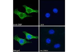 ABIN6391343 Immunofluorescence analysis of paraformaldehyde fixed NIH3T3 cells, permeabilized with 0. (CTGF antibody  (AA 111-123))