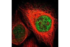 Immunofluorescent staining of U-2 OS with ZIC1 polyclonal antibody  (Green) shows positivity in nucleus but excluded from the nucleoli. (ZIC1 antibody)