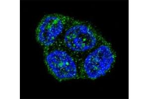 Confocal immunofluorescent analysis of FAS antibody with T47D cells followed by Alexa Fluor 488-conjugated goat anti-rabbit lgG (green).