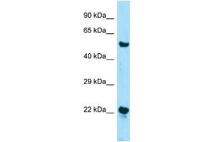 Western Blotting (WB) image for anti-Zinc Finger, DHHC-Type Containing 12 (ZDHHC12) (N-Term) antibody (ABIN2501343) (ZDHHC12 antibody  (N-Term))