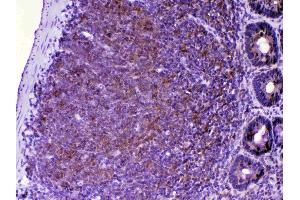 IHC analysis of CTLA4 using anti-CTLA4 antibody . (CTLA4 antibody  (AA 36-161))