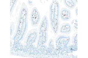 Immunohistochemistry (IHC) image for anti-CD8a Molecule (CD8A) (AA 28-194) antibody (ABIN7453877) (Recombinant CD8 alpha antibody  (AA 28-194))