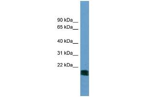 WB Suggested Anti-NT5M  Antibody Titration: 0. (NT5M antibody  (N-Term))