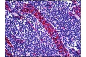 Human Tonsil, Vessel: Formalin-Fixed, Paraffin-Embedded (FFPE) (CD31 antibody  (C-Term))