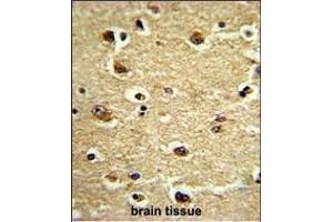 Formalin-fixed and paraffin-embedded human brain tissue reacted with CROT Antibody (N-term), which was peroxidase-conjugated to the secondary antibody, followed by DAB staining. (CROT antibody  (N-Term))