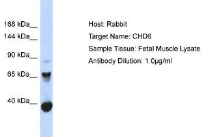 Host: Rabbit Target Name: CHD6 Sample Type: Fetal Muscle lysates Antibody Dilution: 1. (CHD6 antibody  (C-Term))