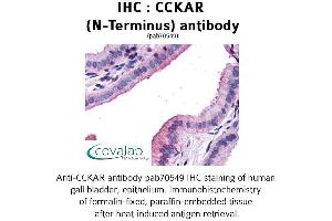 Image no. 1 for anti-Cholecystokinin A Receptor (CCKAR) (Extracellular Domain), (N-Term) antibody (ABIN1732733) (CCKAR antibody  (Extracellular Domain, N-Term))
