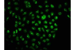 Immunofluorescence (IF) image for anti-Translin-Associated Factor X (TSNAX) (AA 1-87) antibody (ABIN7172910)