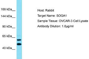 Host: Rabbit Target Name: SOGA1 Sample Type: OVCAR-3 Whole Cell lysates Antibody Dilution: 1. (SOGA1 antibody  (C-Term))