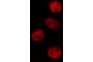 ABIN6266470 staining K562 by IF/ICC. (MAPKAP Kinase 5 antibody  (pThr182))