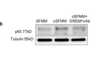 Western Blotting (WB) image for anti-Tumor Protein P63 (TP63) antibody (ABIN2855394)