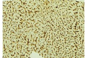 ABIN6273820 at 1/100 staining Mouse liver tissue by IHC-P. (VRK2 antibody  (Internal Region))