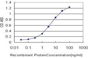 Detection limit for recombinant GST tagged RORB is approximately 0. (RORB antibody  (AA 136-224))