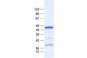Validation with Western Blot (LIN28B Protein (His tag))