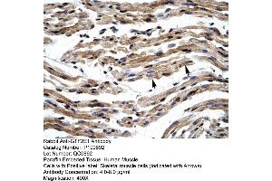 Human Muscle (GTF2E1 antibody  (C-Term))