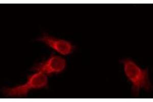 ABIN6275718 staining HeLa by IF/ICC. (RNF130 antibody  (Internal Region))