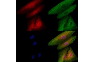 ABIN6256863 and ABIN6273491 staining  cells by IF/ICC. (MAPK13 antibody  (C-Term))