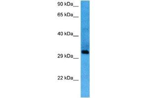 Host:  Mouse  Target Name:  SIX1  Sample Tissue:  Mouse Spleen  Antibody Dilution:  1ug/ml (SIX Homeobox 1 antibody  (Middle Region))