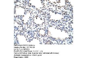 Rabbit Anti-CSDC2 Antibody  Paraffin Embedded Tissue: Human Lung Cellular Data: Alveolar cells Antibody Concentration: 4. (CSDC2 antibody  (N-Term))