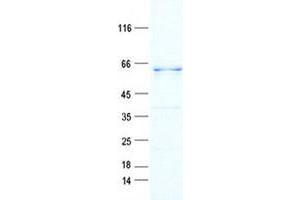 Western Blotting (WB) image for Epidermal Growth Factor Receptor (EGFR) protein (DYKDDDDK Tag) (ABIN5505628)