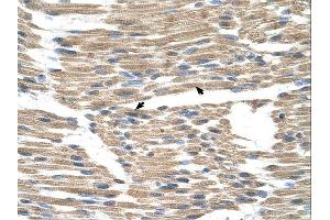 GPR177 antibody was used for immunohistochemistry at a concentration of 4-8 ug/ml. (GPR177/WLS antibody  (N-Term))
