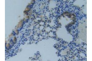 IHC-P analysis of Mouse Lung Tissue, with DAB staining. (MMP14 antibody  (AA 121-487))