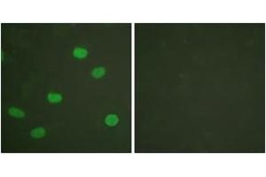 Immunofluorescence analysis of HeLa cells, using Lamin A/C (Phospho-Ser392) Antibody. (Lamin A/C antibody  (pSer392))