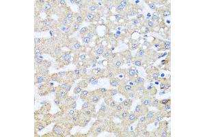 Immunohistochemistry of paraffin-embedded human liver injury using ARL6 antibody (ABIN5974886) at dilution of 1/100 (40x lens). (ARL6 antibody)