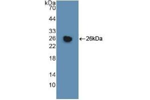 Western blot analysis of recombinant Human GSTm1. (GSTM1 antibody  (AA 1-218))