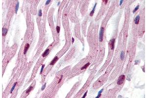 Immunohistochemistry (Paraffin-embedded Sections) (IHC (p)) image for anti-alpha Tubulin (TUBA1) antibody (ABIN93894)