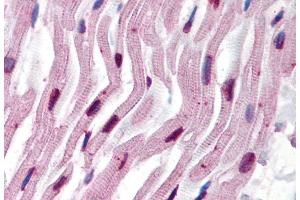 Immunohistochemistry staining of human heart (paraffin sections) using anti-alpha tubulin (TU-16). (alpha Tubulin antibody)