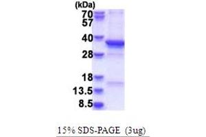 SDS-PAGE (SDS) image for Ts Translation Elongation Factor, Mitochondrial (TSFM) (AA 46-346) protein (ABIN5853717)