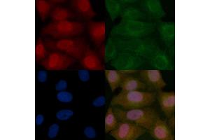 PKC alpha Mouse Monoclonal Antibody staining Hela cells by IF/ICC.