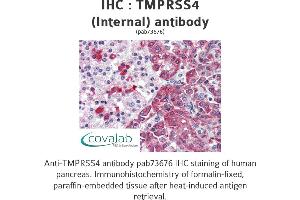 Image no. 1 for anti-Transmembrane Protease, serine 4 (TMPRSS4) (Internal Region) antibody (ABIN1740175) (TMPRSS4 antibody  (Internal Region))