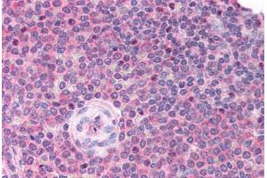 Human Spleen (formalin-fixed, paraffin-embedded) stained with LDB1 antibody ABIN214791 at 5 ug/ml followed by biotinylated goat anti-rabbit IgG secondary antibody ABIN481713, alkaline phosphatase-streptavidin and chromogen. (LIM Domain Binding 1 Protein antibody  (AA 303-352))