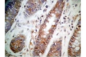 Human colon tissue was stained by Rabbit Anti-GLP-1 (12-24) (Human) Antibody (GLP-1 antibody  (AA 12-24))
