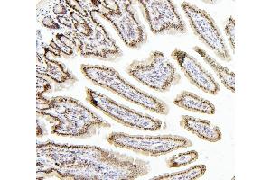 IHC analysis of PTBP1 using anti-PTBP1 antibody (ABIN7599451). (PTBP1 antibody  (AA 1-504))