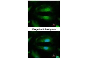 ICC/IF Image Immunofluorescence analysis of paraformaldehyde-fixed HeLa, using Selenophosphate synthetase 1, antibody at 1:200 dilution. (SEPHS1 antibody)