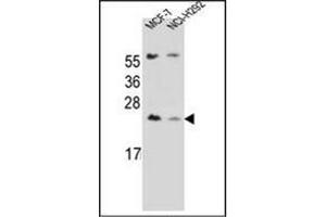 Western blot analysis of LIN7C Antibdy (C-term) in MCF-7, NCI-H292 cell line lysates (35ug/lane).