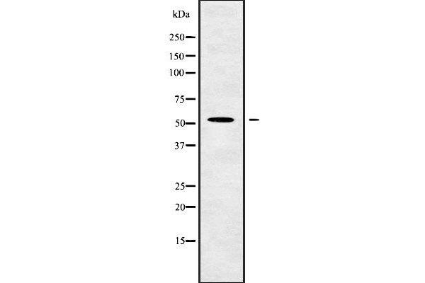 GCNT4 antibody  (Internal Region)