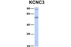 Host:  Rabbit  Target Name:  KCNC3  Sample Type:  Human Fetal Lung  Antibody Dilution:  1. (KCNC3 antibody  (Middle Region))